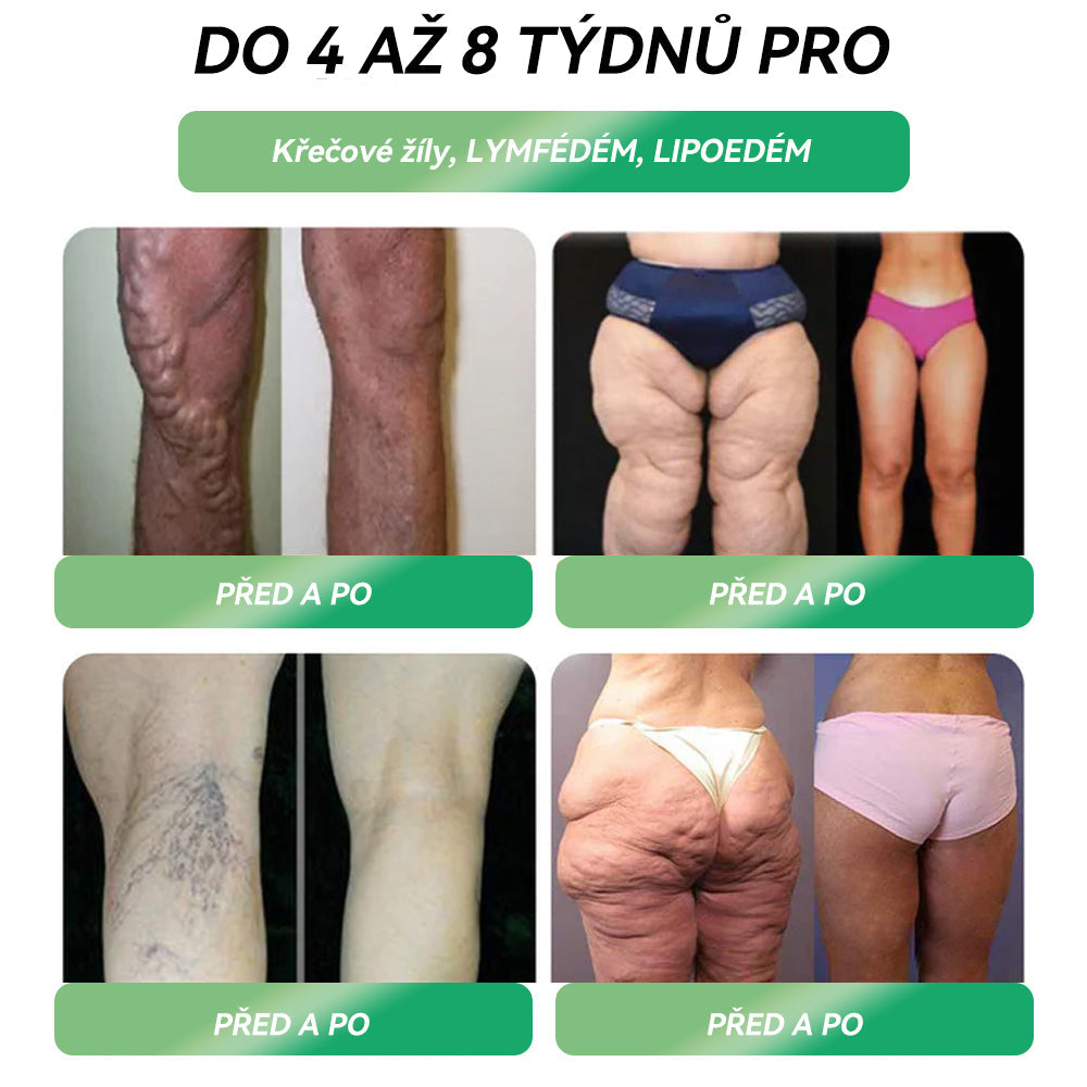 🌼FNUSAD Doporuěené |Oficiální obchod | 𝑆𝑇𝐷™ 𝐺𝐿𝑃-1 𝐻𝑢𝑏𝑛𝑢𝑡í Ú𝑠𝑡𝑛í ř𝑒š𝑒𝑛í - 👨‍⚕️ Obezita, kardiovaskulární onemocnění, cukrovka, spánková apnoe, problémy s klouby a další